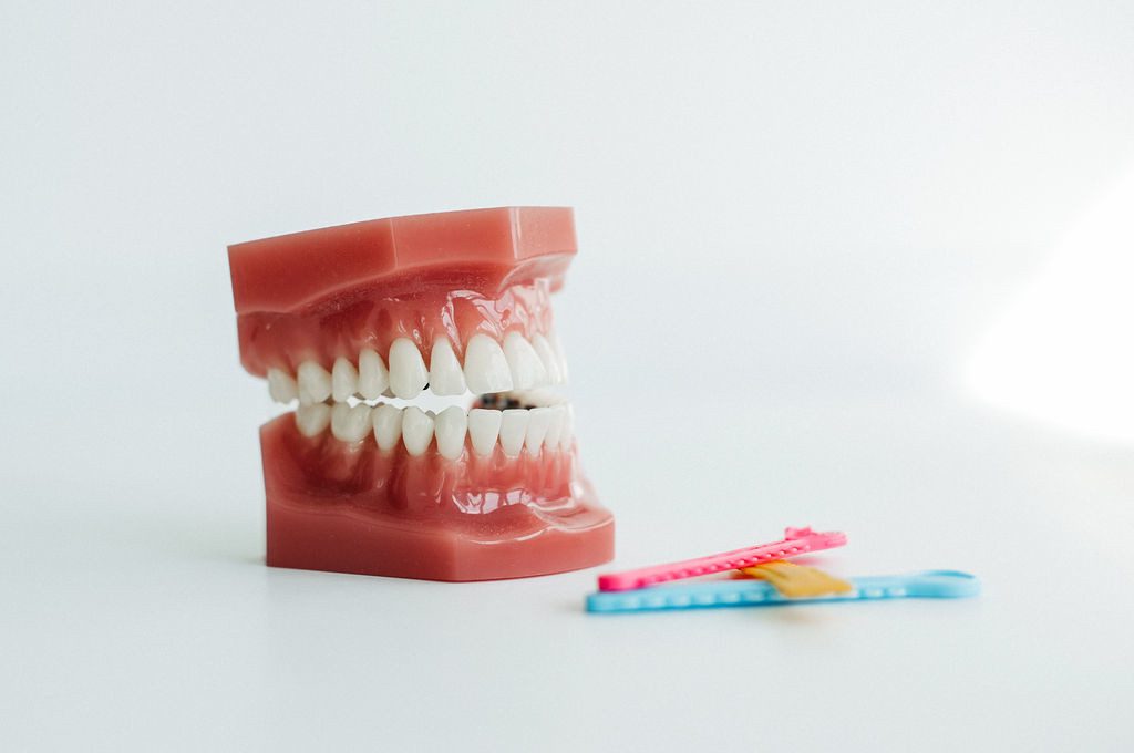 Ein kieferorthopädisches Zahnmodell mit vollständigem Gebiss steht auf einer weißen Fläche. Die Zähne wirken gleichmäßig und gepflegt, wobei die Spange von außen nicht sichtbar ist – ein Hinweis auf die unsichtbare feste Zahnspange, die auf der Innenseite der Zähne befestigt wird. Daneben liegen zwei bunte Hilfsmittel zur Zahnpflege in Pink und Blau. Die Szene symbolisiert moderne, ästhetische Kieferorthopädie und sorgfältige Mundhygiene.