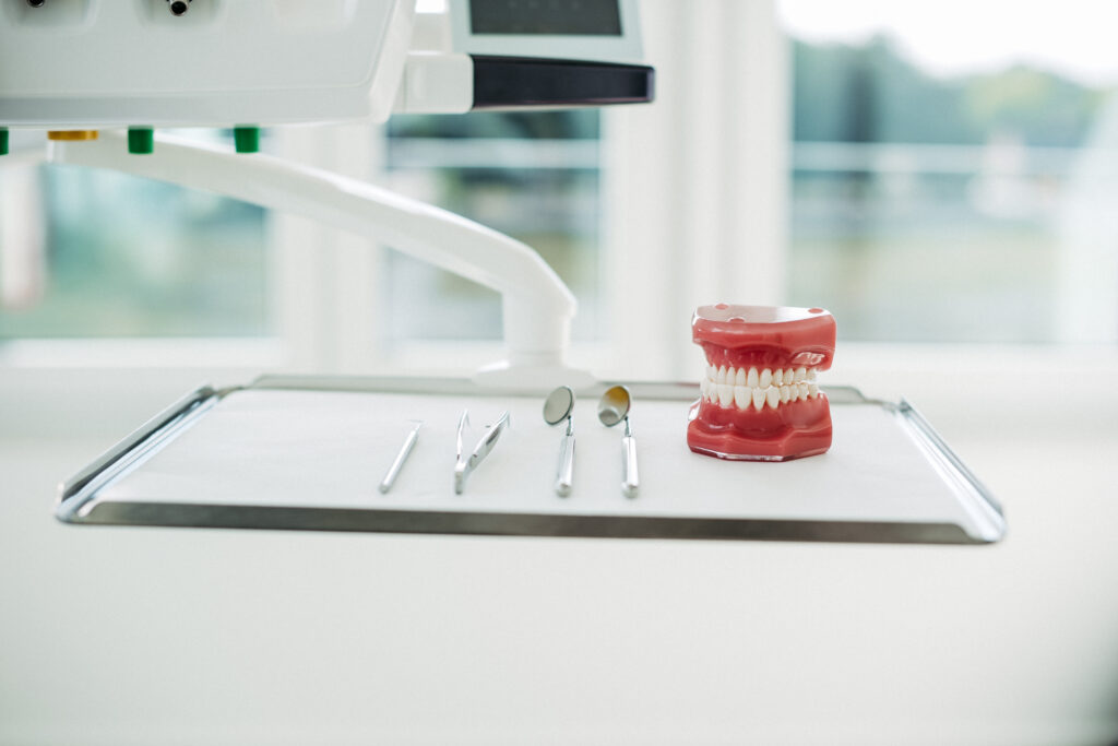 WIN Lingualtechnik bei U Smile: Die von außen nahezu unsichtbare feste Zahnspange